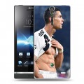 Дизайнерский пластиковый чехол для Sony Xperia S