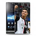 Дизайнерский пластиковый чехол для Sony Xperia S