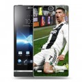 Дизайнерский пластиковый чехол для Sony Xperia S