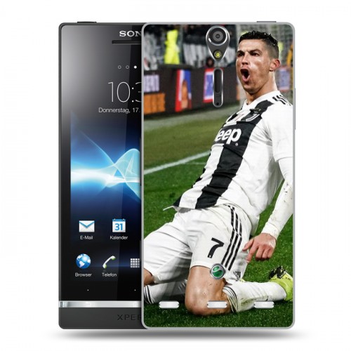 Дизайнерский пластиковый чехол для Sony Xperia S