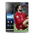 Дизайнерский пластиковый чехол для Sony Xperia S