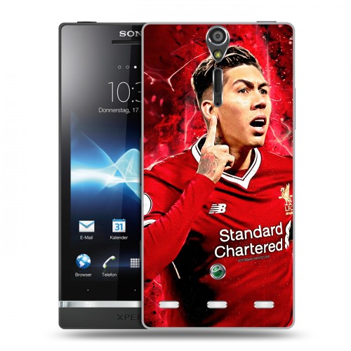 Дизайнерский пластиковый чехол для Sony Xperia S