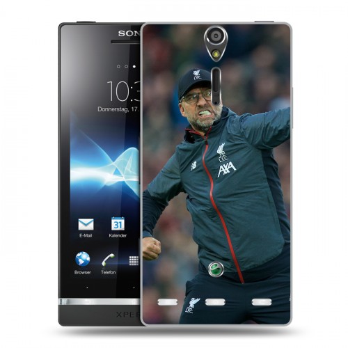 Дизайнерский пластиковый чехол для Sony Xperia S