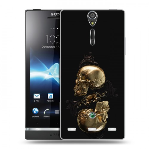 Дизайнерский пластиковый чехол для Sony Xperia S Черное золото