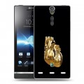 Дизайнерский пластиковый чехол для Sony Xperia S Черное золото