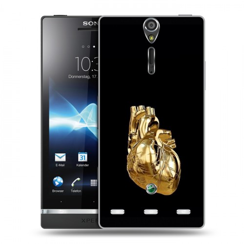 Дизайнерский пластиковый чехол для Sony Xperia S Черное золото