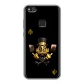 Дизайнерский силиконовый чехол для Huawei P10 Lite Золотой скрудж макдак