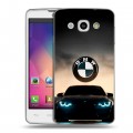 Дизайнерский пластиковый чехол для LG L60 БМВ BMW