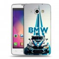 Дизайнерский пластиковый чехол для LG L60 БМВ BMW