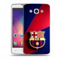 Дизайнерский пластиковый чехол для LG L60 Барселона Barcelona