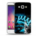 Дизайнерский пластиковый чехол для LG L60 Король лев
