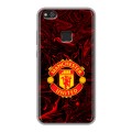 Дизайнерский силиконовый чехол для Huawei P10 Lite Manchester United
