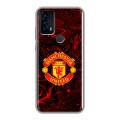 Дизайнерский силиконовый чехол для TCL 20B Manchester United