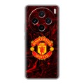 Дизайнерский силиконовый чехол для Vivo X100 Manchester United