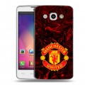 Дизайнерский пластиковый чехол для LG L60 Manchester United
