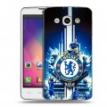 Дизайнерский пластиковый чехол для LG L60 Chelsea Челси