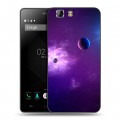 Дизайнерский силиконовый чехол для Doogee X5 Галактика