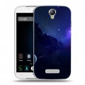 Дизайнерский пластиковый чехол для Doogee X6 Галактика