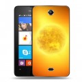 Дизайнерский силиконовый чехол для Microsoft Lumia 430 Dual SIM Солнце