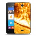 Дизайнерский силиконовый чехол для Microsoft Lumia 430 Dual SIM Солнце