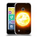 Дизайнерский пластиковый чехол для Nokia Lumia 530 Солнце