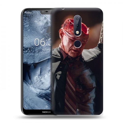 Дизайнерский пластиковый чехол для Nokia 6.1 Plus Ганнибал