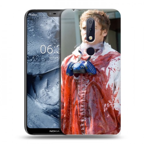 Дизайнерский пластиковый чехол для Nokia 6.1 Plus Декстер