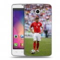 Дизайнерский пластиковый чехол для LG L60