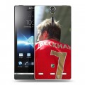 Дизайнерский пластиковый чехол для Sony Xperia S