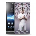 Дизайнерский пластиковый чехол для Sony Xperia S