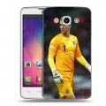 Дизайнерский пластиковый чехол для LG L60