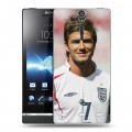 Дизайнерский пластиковый чехол для Sony Xperia S