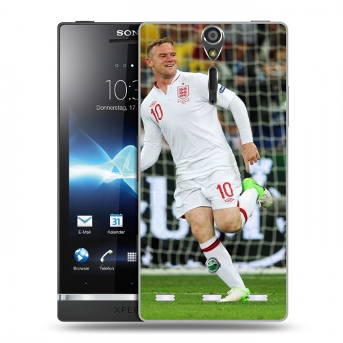 Дизайнерский пластиковый чехол для Sony Xperia S