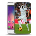 Дизайнерский пластиковый чехол для LG L60