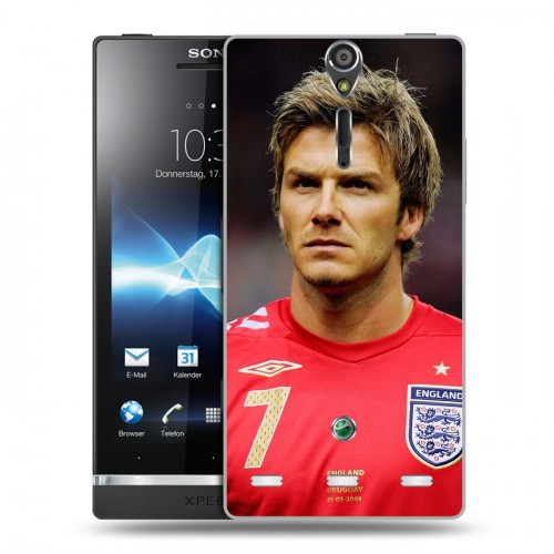 Дизайнерский пластиковый чехол для Sony Xperia S