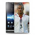 Дизайнерский пластиковый чехол для Sony Xperia S