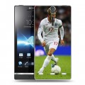 Дизайнерский пластиковый чехол для Sony Xperia S