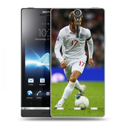 Дизайнерский пластиковый чехол для Sony Xperia S