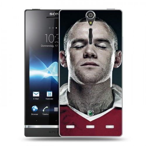 Дизайнерский пластиковый чехол для Sony Xperia S