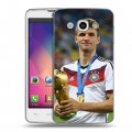 Дизайнерский пластиковый чехол для LG L60