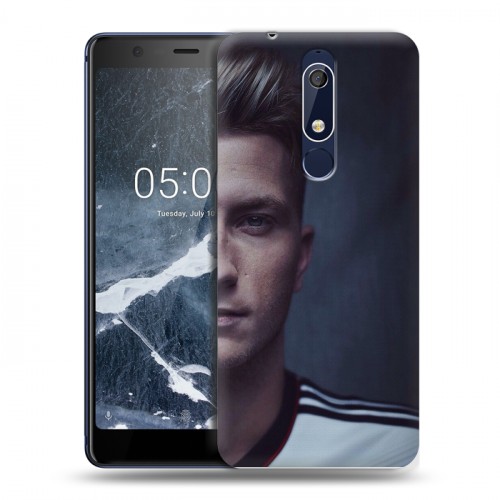 Дизайнерский пластиковый чехол для Nokia 5.1