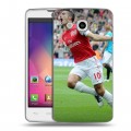 Дизайнерский пластиковый чехол для LG L60