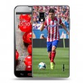 Дизайнерский пластиковый чехол для LG Optimus G