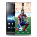 Дизайнерский пластиковый чехол для Sony Xperia S