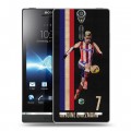 Дизайнерский пластиковый чехол для Sony Xperia S