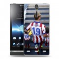 Дизайнерский пластиковый чехол для Sony Xperia S