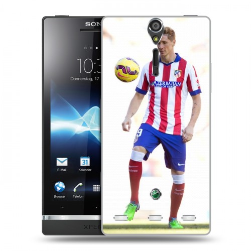 Дизайнерский пластиковый чехол для Sony Xperia S