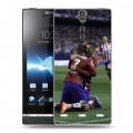 Дизайнерский пластиковый чехол для Sony Xperia S