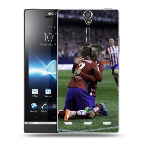 Дизайнерский пластиковый чехол для Sony Xperia S