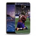 Дизайнерский пластиковый чехол для Nokia 7 Plus